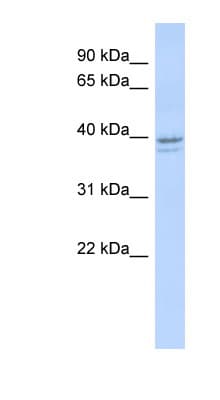 Polyclonal Rabbit anti-Human RRM2 Antibody (aa35-84, WB)