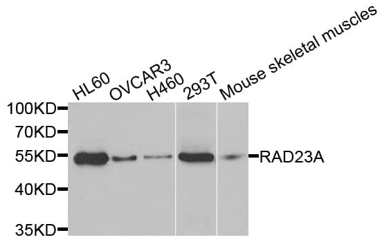 Polyclonal Rabbit anti-Human RAD23A / HHR23A Antibody (IHC, WB)