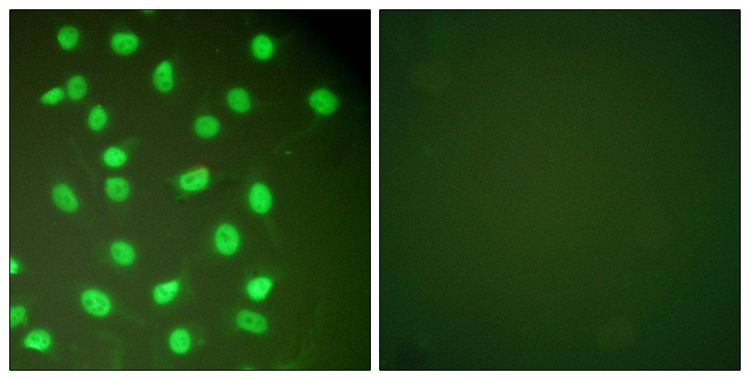 Polyclonal Rabbit anti-Human MCM2 Antibody (IHC, IF, WB)