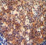 IL12B / IL12 p40 Antibody (aa264-290)