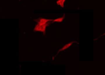 NBPF1+9+10+12+14+15+16+20 Antibody