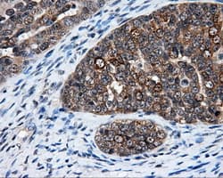 ELAVL1 / HUR Antibody (clone OTI14F4)