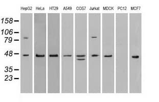 IHC-plus™ Monoclonal Mouse anti-Human SSB / La Antibody (clone 9D6, IHC, IF, WB)