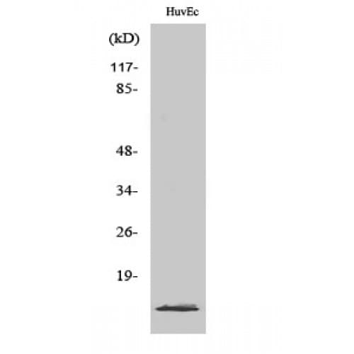 Polyclonal Rabbit anti-Human TP53I11 / PIG11 Antibody (40-120 aa, Internal, IHC, IF, WB)