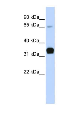 TNNT1 / TNT Antibody (C-Terminus)