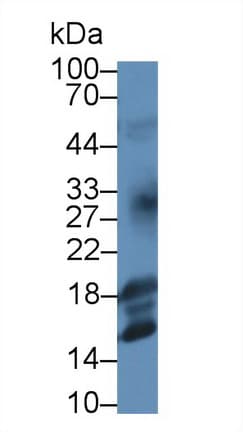 IGF1 Antibody (clone C1)