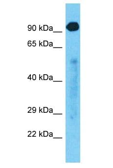 HELQ / HEL308 Antibody (aa203-252)
