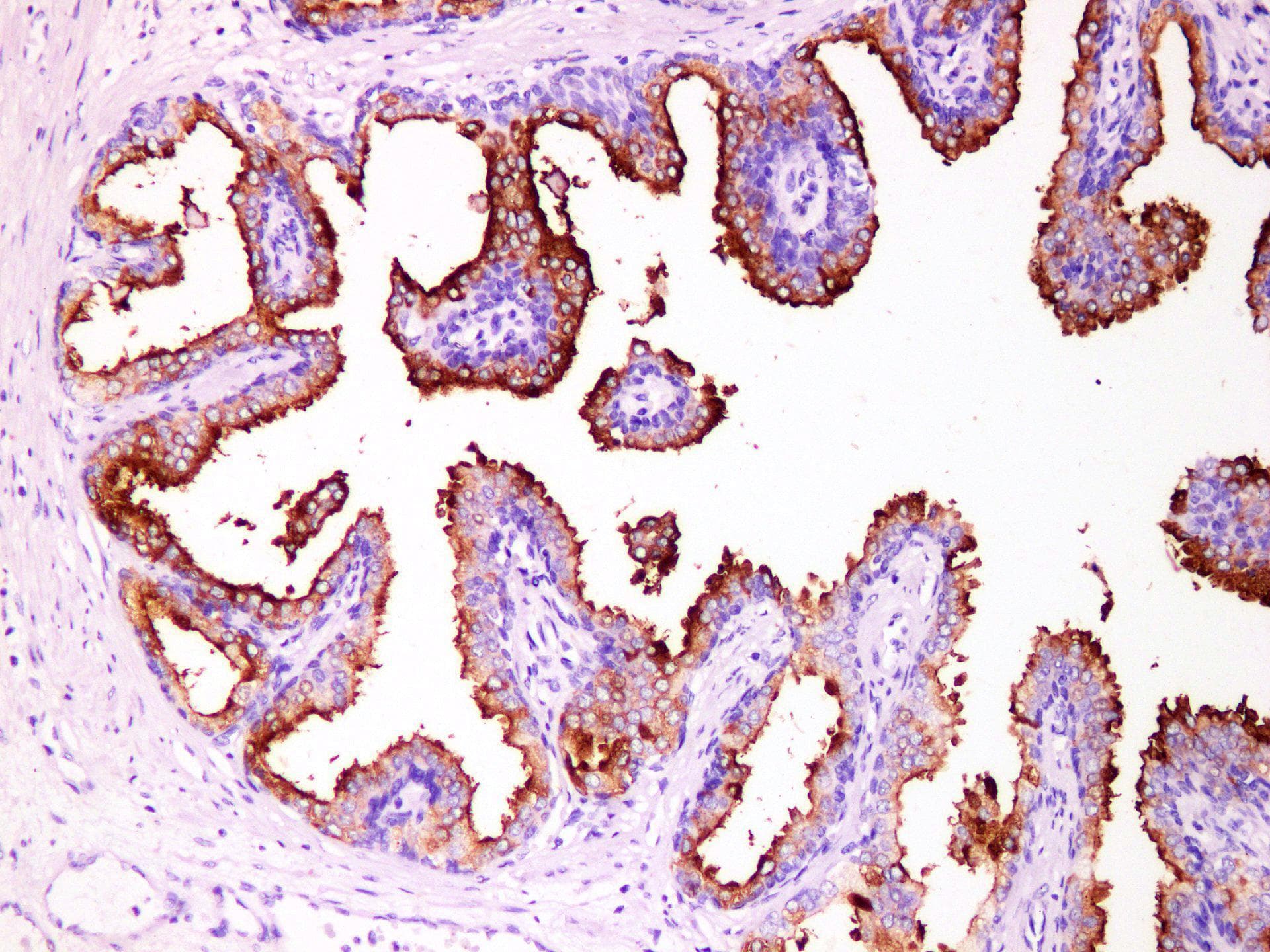 FOLH1 / PSMA Antibody
