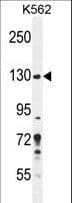 PLEKHG3 Antibody (aa1178-1207)