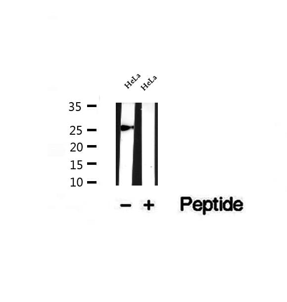 SNRPB2 Antibody