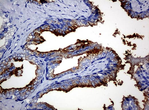 FOLH1 / PSMA Antibody (clone UMAB26)