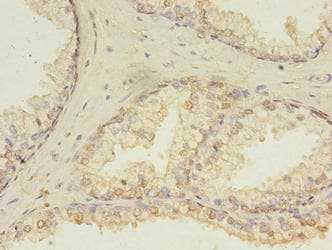 HDDC3 Antibody (aa2-140)