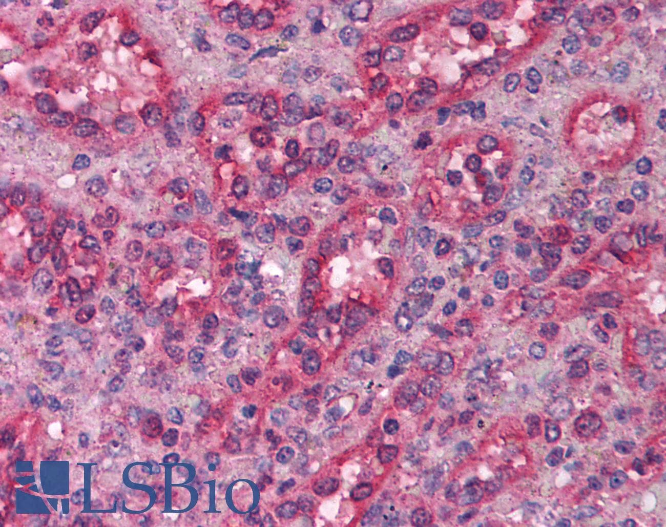 LHX1 Antibody (aa120-169)