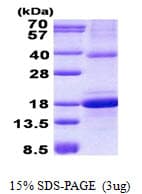 Human CLEC2D / OCIL / LLT1 Protein (Recombinant His)