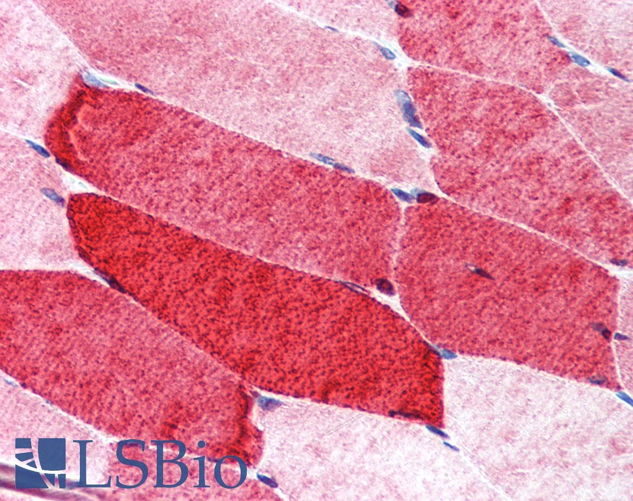 IHC-plus™ Raptor / Mip1 Antibody