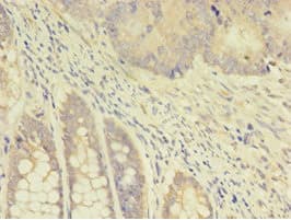 TK1 / TK / Thymidine Kinase Antibody (aa2-234)