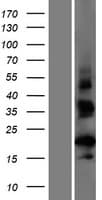 CT62 Protein (Over-Expression Lysate Myc-DDK (Flag))