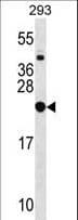 Polyclonal Rabbit anti-Human RPL9 / Ribosomal Protein L9 Antibody (aa149-177, WB)