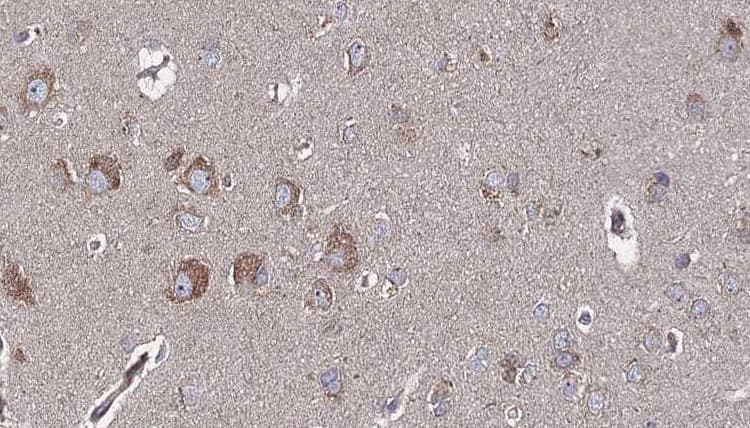 DHFR Antibody