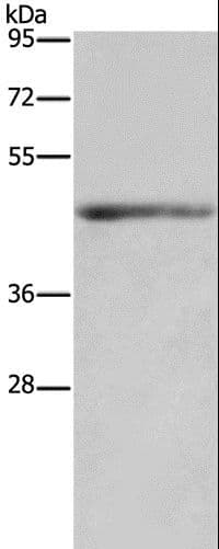 IL5RA / CD125 Antibody