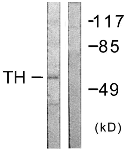 Polyclonal Rabbit anti-Human TH / Tyrosine Hydroxylase Antibody (aa5-54, IHC, WB)