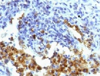 NAPSA / NAPA / Napsin A Antibody (clone NPSNA-1)