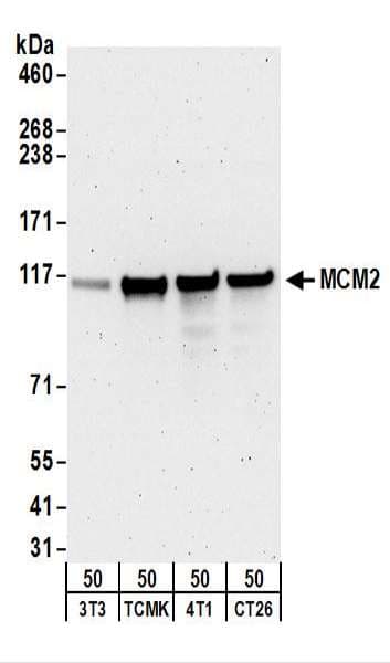 IHC-plus™ MCM2 Antibody (aa1-50)