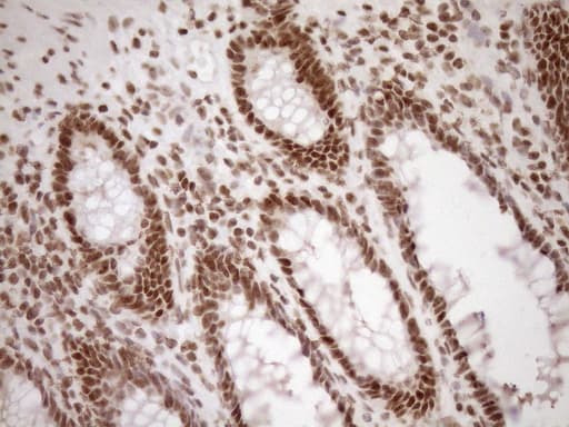 EXOSC1 / CSL4 Antibody (clone OTI1H9)