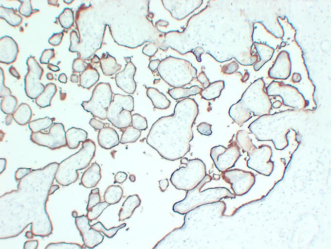 Monoclonal Mouse anti-Human CD105 Antibody (clone ABT-CD105, IHC)