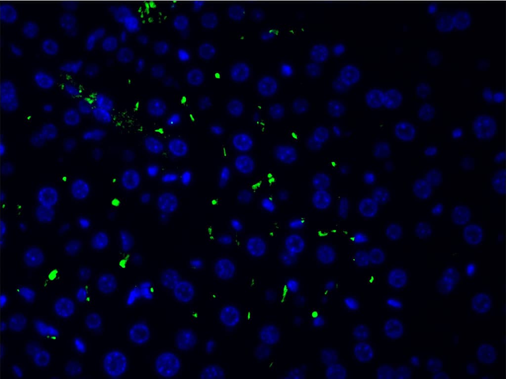 LIMK1 / LIMK Antibody (phospho-Thr508)