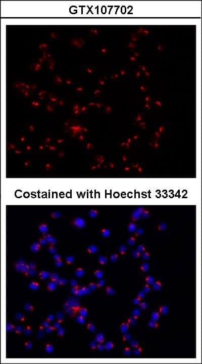 GOLM1 / GP73 / GOLPH2 Antibody (aa339-401)