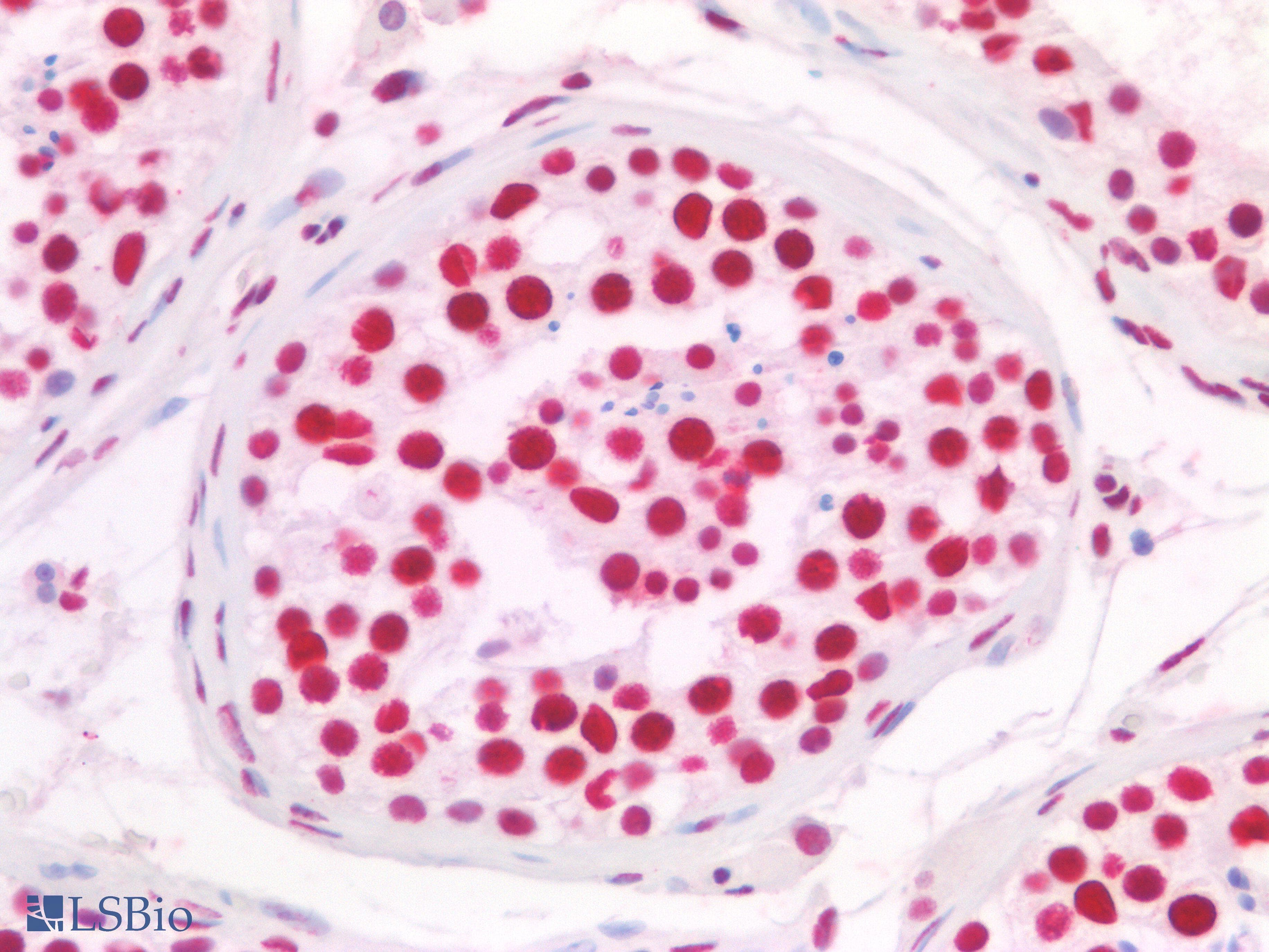 PathPlus™ NF45 / ILF2 Antibody (clone OTI6F1)