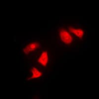 Polyclonal Rabbit anti-Human CHEK1 / CHK1 Antibody (Internal, IHC, IF, WB)
