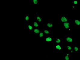 COPS5 / JAB1 Antibody (clone OTI2B12)