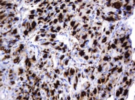 GLB1 / Beta-Galactosidase Antibody (clone OTI1C9)