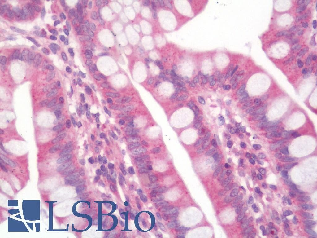 IHC-plus™ RIPK1 / RIP Antibody (aa152-180)