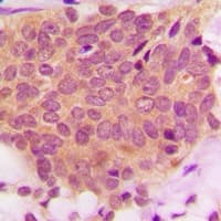 Polyclonal Rabbit anti-Human Ezrin + Radixin + Moesin Antibody (C-Terminus, IHC, WB)
