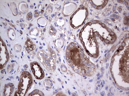 GARS / Glycyl tRNA Synthetase Antibody (clone OTI4G4)