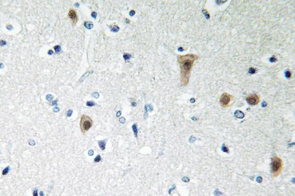 Polyclonal Rabbit anti-Human HSF1 Antibody (phospho-Ser303, IHC, IF, WB)