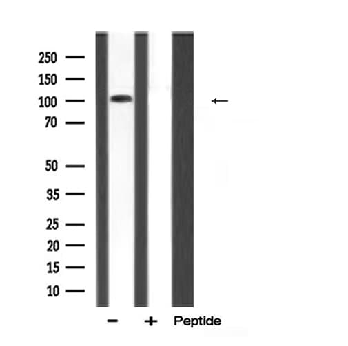DAP-5 / EIF4G2 Antibody