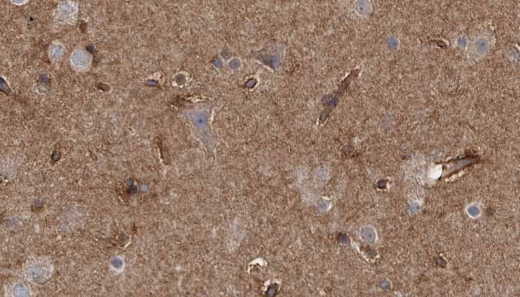 Polyclonal Rabbit anti-Human DCX / Doublecortin Antibody (phospho-Ser334, IHC, WB)