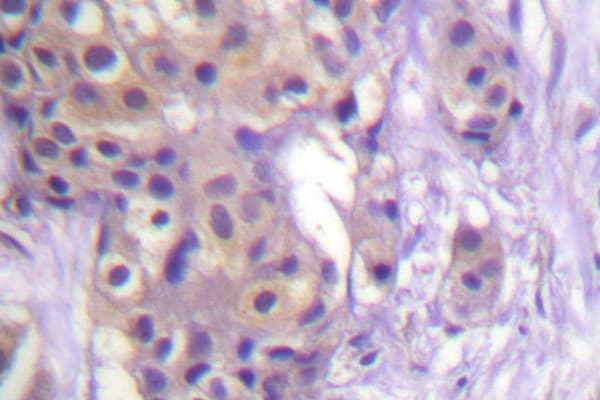IKBKB / IKK2 / IKK Beta Antibody (Leu193)