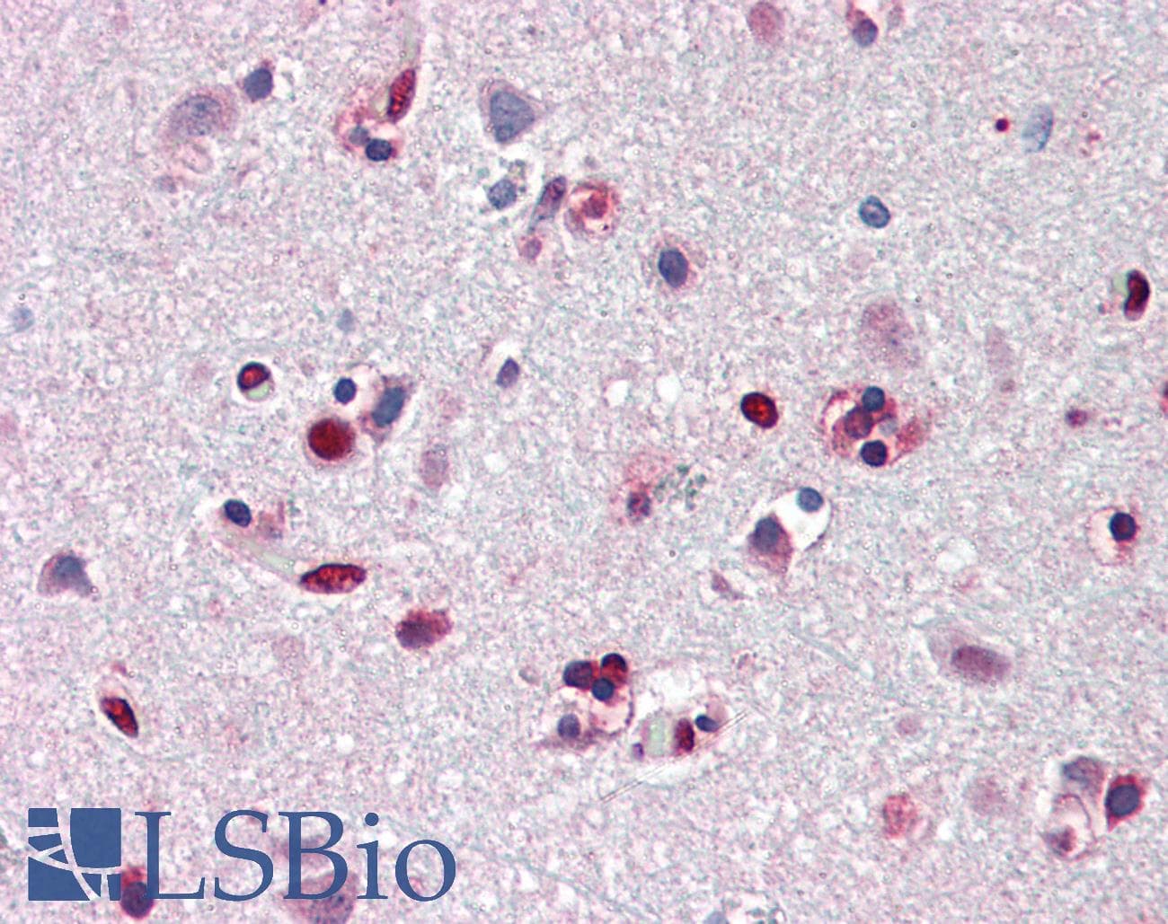 IHC-plus™ PHAP1 / ANP32A Antibody