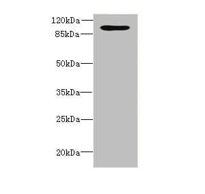 Polyclonal Rabbit anti-Human OPHN1 Antibody (IHC, WB)