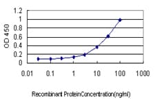 DAZ1 / DAZ Antibody (clone 3A4)