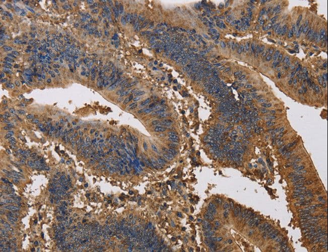 K13 / KCNG Antibody