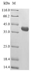 Alpha-bungarotoxin isoform A31 (Bungarus multicinctus) Protein (Recombinant 10His-GST, N-terminus + Myc, C-terminus)