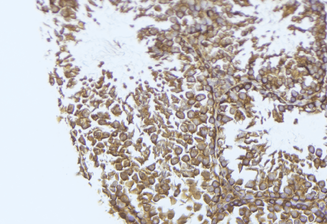 Polyclonal Rabbit anti-Human COX6B2 Antibody (IHC, WB)