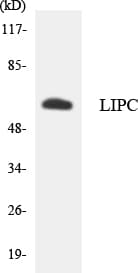 IHC-plus™ LIPC / Hepatic Lipase Antibody (aa290-339)