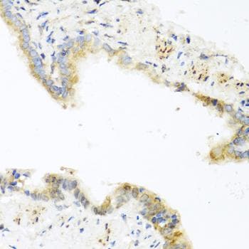 RETN / Resistin Antibody